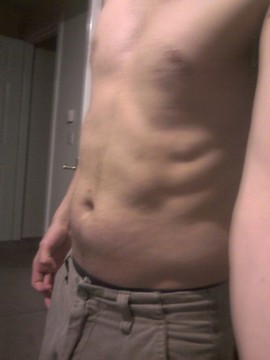 A left photo of my abs before starting the Slendertone 6 Week Plan.